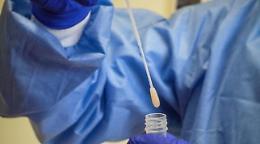 Coronavirus, ad Agrigento in ritardo la consegna dei tamponi molecolari