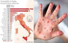 Morbillo in Sicilia, piano straordinario
di vaccinazioni anche per gli adulti