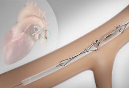 Scompenso cardiaco, impiantato a Catania il primo sensore wireless che avvisa i medici se qualcosa non va