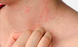 Catania: i cittadini di Vaccarizzo reclamano i loro diritti