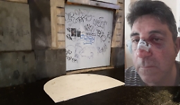 Catania, in via Etnea crolla pannello da un negozio e ferisce un passante